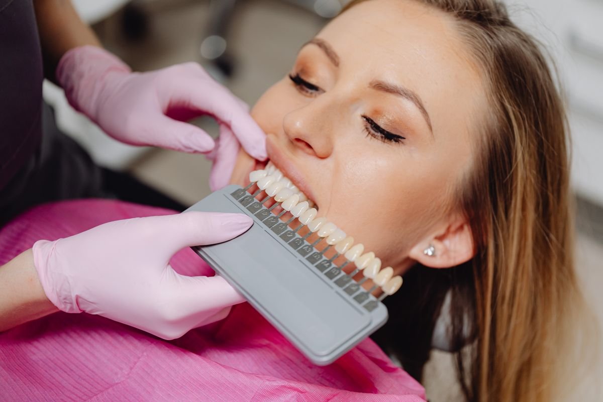 Dentista eligiendo el tono de las carillas dentales de una paciente.