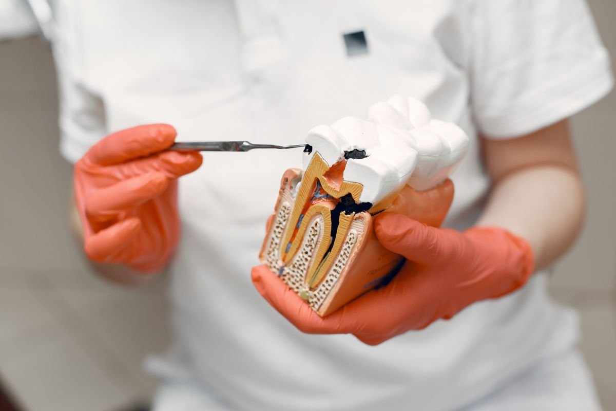 Dentista mostrando un modelo de restauración dental.